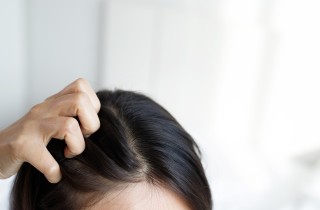 Forfora nei capelli: 5 cose da sapere