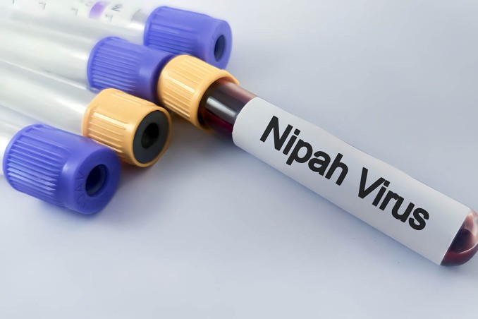 virus Nipah